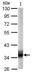 Western blot - Anti-SUCLG1 antibody (AB97867)