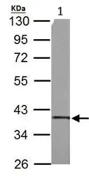 Western blot - Anti-SUCLG1 antibody (AB97867)