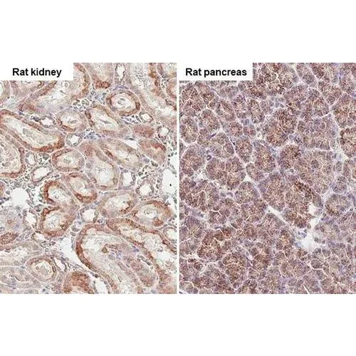 Immunohistochemistry (Formalin/PFA-fixed paraffin-embedded sections) - Anti-SUCLG1 antibody [HL2387] (AB317213)
