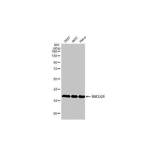 Western blot - Anti-SUCLG1 antibody [HL2387] (AB317213)