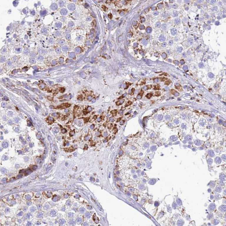 Immunohistochemistry (Formalin/PFA-fixed paraffin-embedded sections) - Anti-SUCLG2 antibody (AB187996)