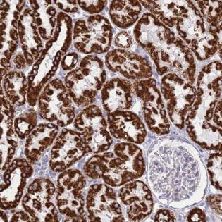 Immunohistochemistry (Formalin/PFA-fixed paraffin-embedded sections) - Anti-SUCLG2 antibody (AB187996)