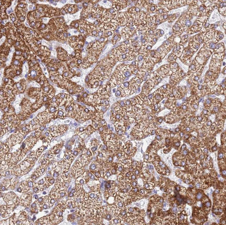 Immunohistochemistry (Formalin/PFA-fixed paraffin-embedded sections) - Anti-SUCLG2 antibody (AB187996)