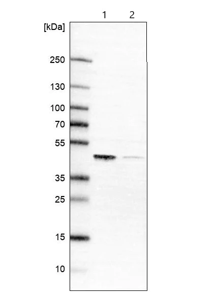 Western blot - Anti-SUCLG2 antibody (AB187996)