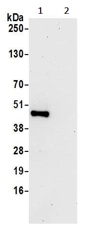 Immunoprecipitation - Anti-SUCLG2 antibody (AB241375)