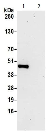 Immunoprecipitation - Anti-SUCLG2 antibody (AB241375)