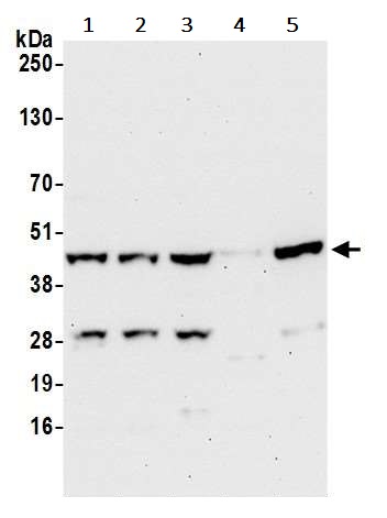 Western blot - Anti-SUCLG2 antibody (AB241375)