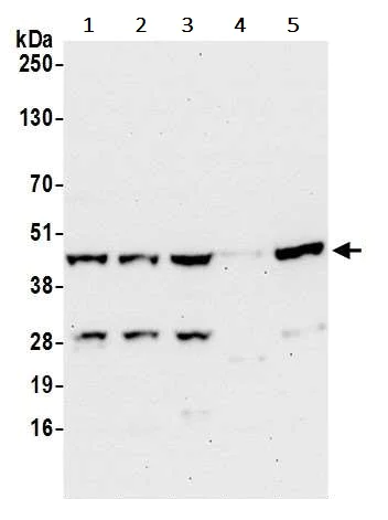 Western blot - Anti-SUCLG2 antibody (AB241375)