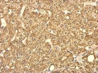 Immunohistochemistry (Formalin/PFA-fixed paraffin-embedded sections) - Anti-SUCLG2 antibody (AB96172)