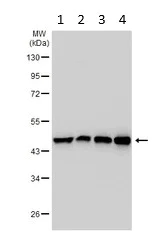 Western blot - Anti-SUCLG2 antibody (AB96172)
