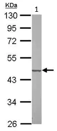 Western blot - Anti-SUCLG2 antibody (AB96172)
