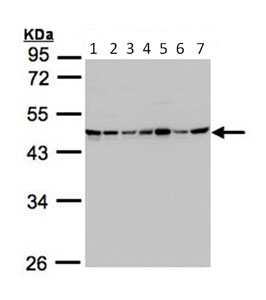 Western blot - Anti-SUCLG2 antibody (AB96172)