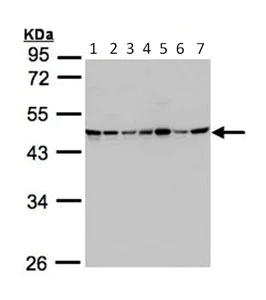 Western blot - Anti-SUCLG2 antibody (AB96172)
