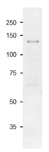 Western blot - Anti-Sucrose-Phosphate Synthase, Plant antibody (AB243200)
