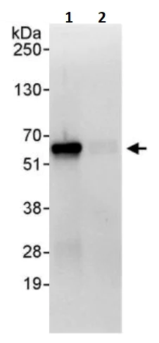 Immunoprecipitation - Anti-SUFU antibody (AB245428)