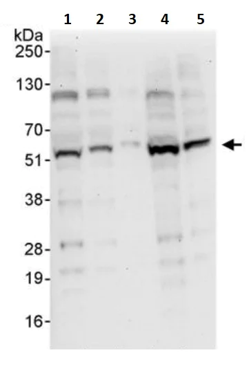Western blot - Anti-SUFU antibody (AB245428)