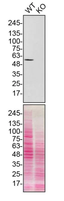 Western blot - Anti-SUFU antibody (AB28083)