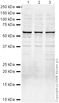 Western blot - Anti-SUFU antibody (AB28083)