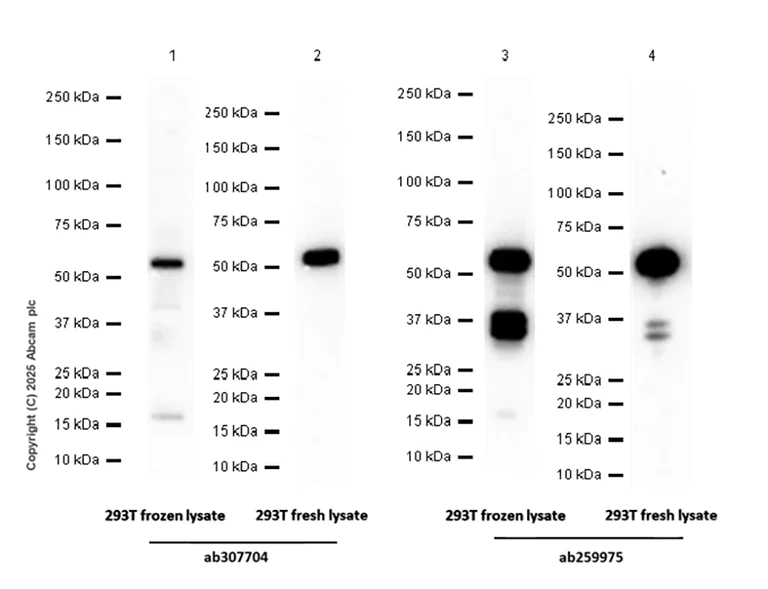 Western blot - Anti-SUFU antibody [EPR26229-17] (AB307704)