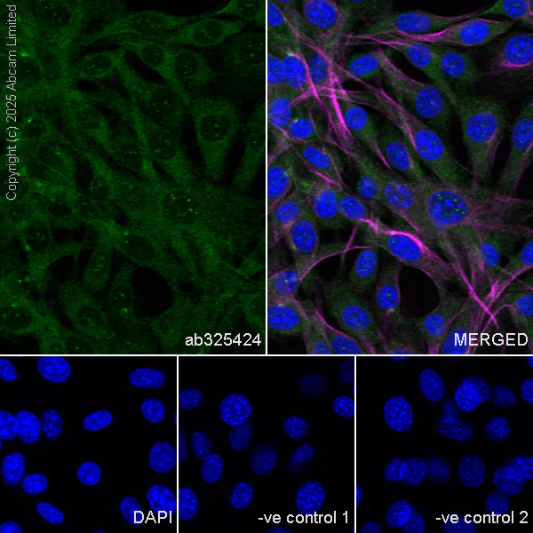 Immunocytochemistry/ Immunofluorescence - Anti-SUFU antibody [EPR30547-60] (AB325424)