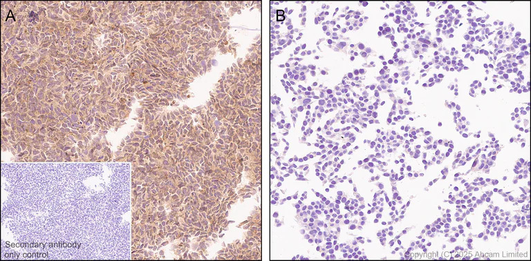 Immunohistochemistry (Formalin/PFA-fixed paraffin-embedded sections) - Anti-SUFU antibody [EPR30547-60] (AB325424)