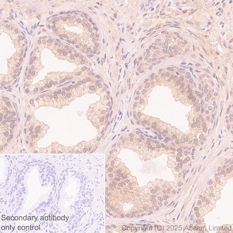 Immunohistochemistry (Formalin/PFA-fixed paraffin-embedded sections) - Anti-SUFU antibody [EPR30547-60] (AB325424)
