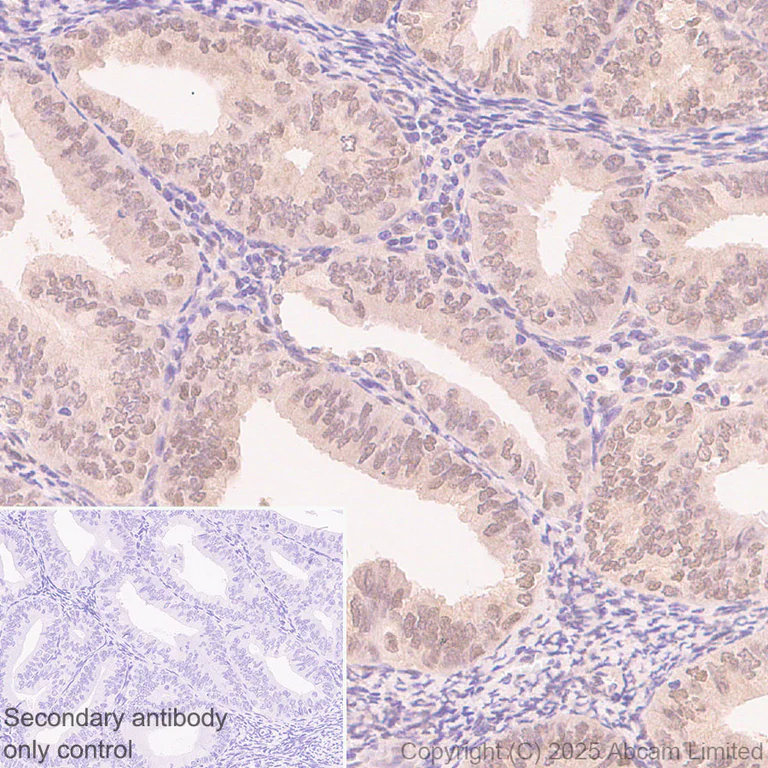 Immunohistochemistry (Formalin/PFA-fixed paraffin-embedded sections) - Anti-SUFU antibody [EPR30547-60] (AB325424)