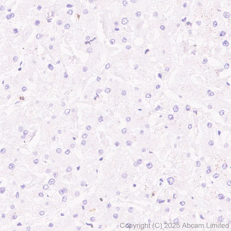 Immunohistochemistry (Formalin/PFA-fixed paraffin-embedded sections) - Anti-SUFU antibody [EPR30547-60] (AB325424)