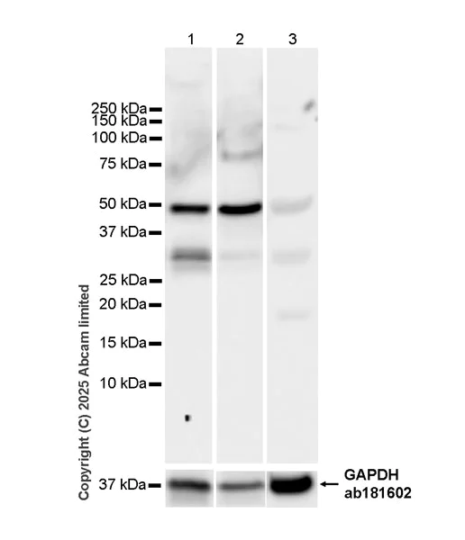 Western blot - Anti-SUFU antibody [EPR30547-60] (AB325424)