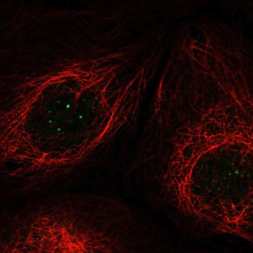 Immunocytochemistry/ Immunofluorescence - Anti-SUGT1 antibody (AB204428), expandable thumbnail