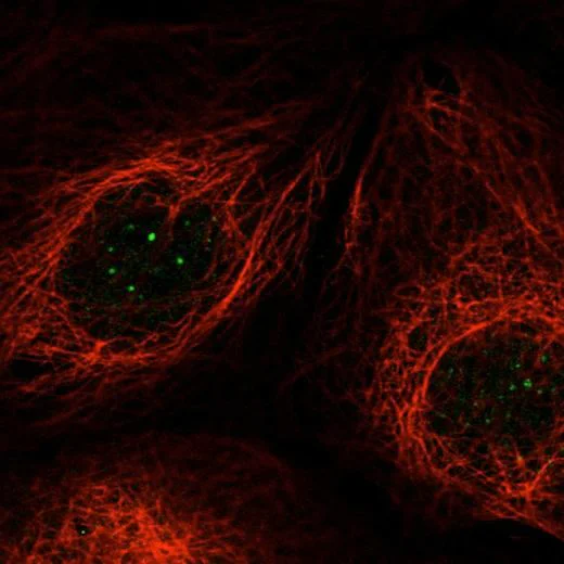 Immunocytochemistry/ Immunofluorescence - Anti-SUGT1 antibody (AB204428)