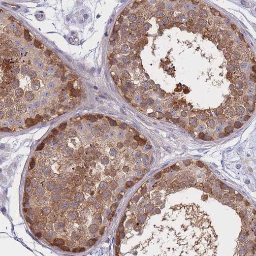 Immunohistochemistry (Formalin/PFA-fixed paraffin-embedded sections) - Anti-SUGT1 antibody (AB204428), expandable thumbnail