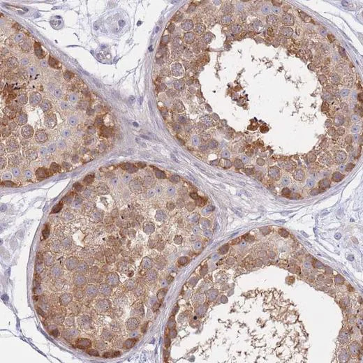 Immunohistochemistry (Formalin/PFA-fixed paraffin-embedded sections) - Anti-SUGT1 antibody (AB204428)