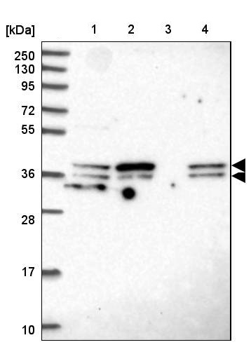 Western blot - Anti-SUGT1 antibody (AB204428), expandable thumbnail