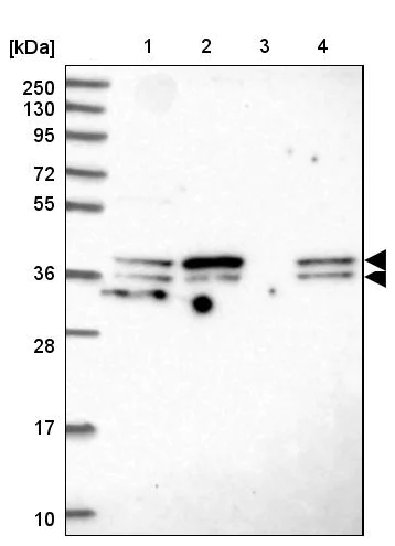 Western blot - Anti-SUGT1 antibody (AB204428)