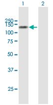 Western blot - Anti-Sulfatase 1/SULF1 antibody (AB168616), expandable thumbnail