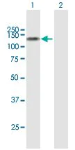 Western blot - Anti-Sulfatase 1/SULF1 antibody (AB168616)