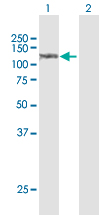 Western blot - Anti-Sulfatase 1/SULF1 antibody (AB172404)