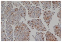 Immunohistochemistry (Formalin/PFA-fixed paraffin-embedded sections) - Anti-Sulfatase 2/SULF2 antibody [2B4] (AB113405)