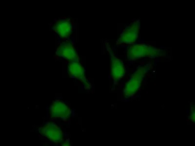 Immunocytochemistry/ Immunofluorescence - Anti-Sulfatase 2/SULF2 antibody (AB232835)