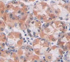Immunohistochemistry (Formalin/PFA-fixed paraffin-embedded sections) - Anti-Sulfatase 2/SULF2 antibody (AB232835)