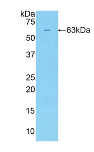 Western blot - Anti-Sulfatase 2/SULF2 antibody (AB232835)