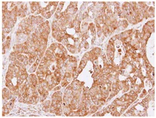 Immunohistochemistry (Formalin/PFA-fixed paraffin-embedded sections) - Anti-SULT1A1/STP antibody (AB155012)