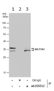 Immunoprecipitation - Anti-SULT1A1/STP antibody (AB155012)