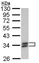 Western blot - Anti-SULT1A1/STP antibody (AB155012)