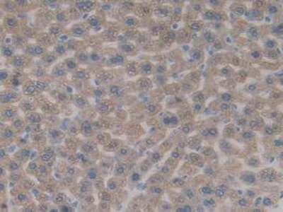 Immunohistochemistry (Formalin/PFA-fixed paraffin-embedded sections) - Anti-SULT1A1/STP antibody (AB231555)