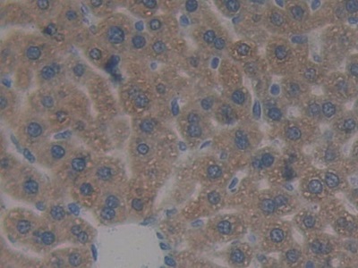 Immunohistochemistry (Formalin/PFA-fixed paraffin-embedded sections) - Anti-SULT1A1/STP antibody (AB231555)