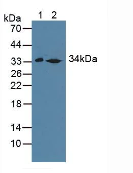 Western blot - Anti-SULT1A1/STP antibody (AB231555)