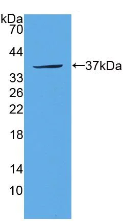Western blot - Anti-SULT1A1/STP antibody (AB231555)