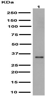 Western blot - Anti-SULT1A1/STP antibody [EPR15532] - N-terminal (AB191069)